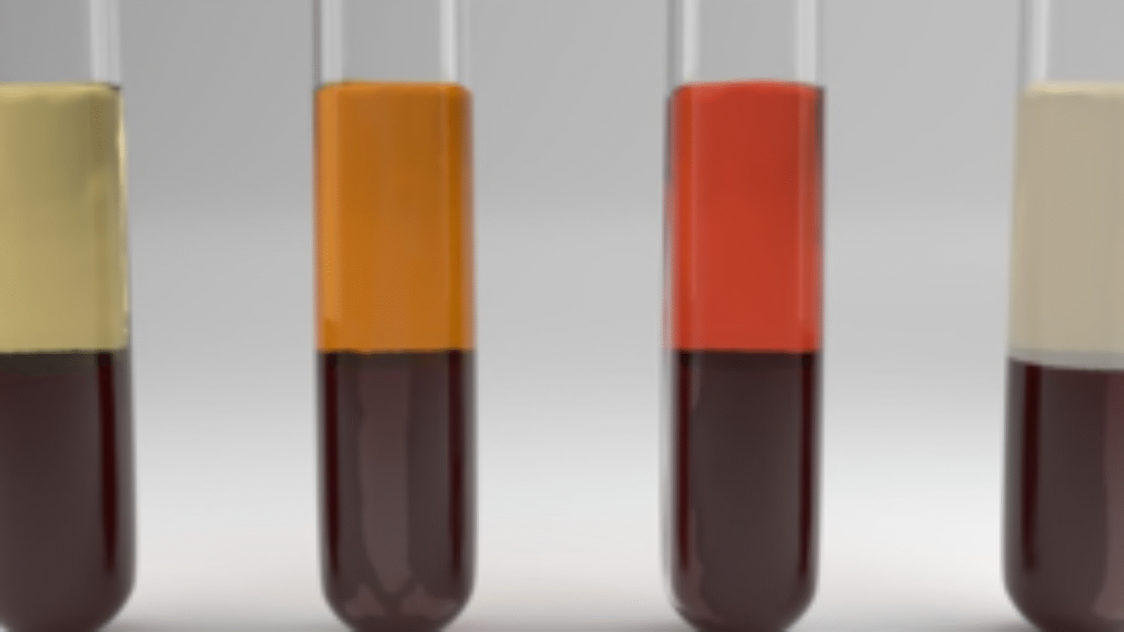 Serumindices en Laboratoriuminterferentie